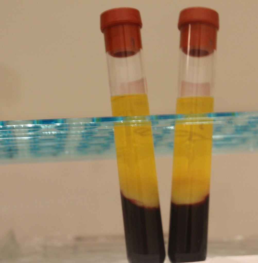 The Healing Power of Platelet Rich Plasma (PRP)
