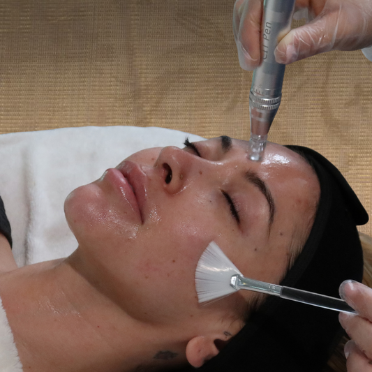 Collagen Induction Therapy (CIT) / Micro-Needling + Nano-Infusion