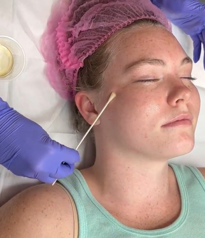 Dermaplane + Nano-Peel Hands-On Training